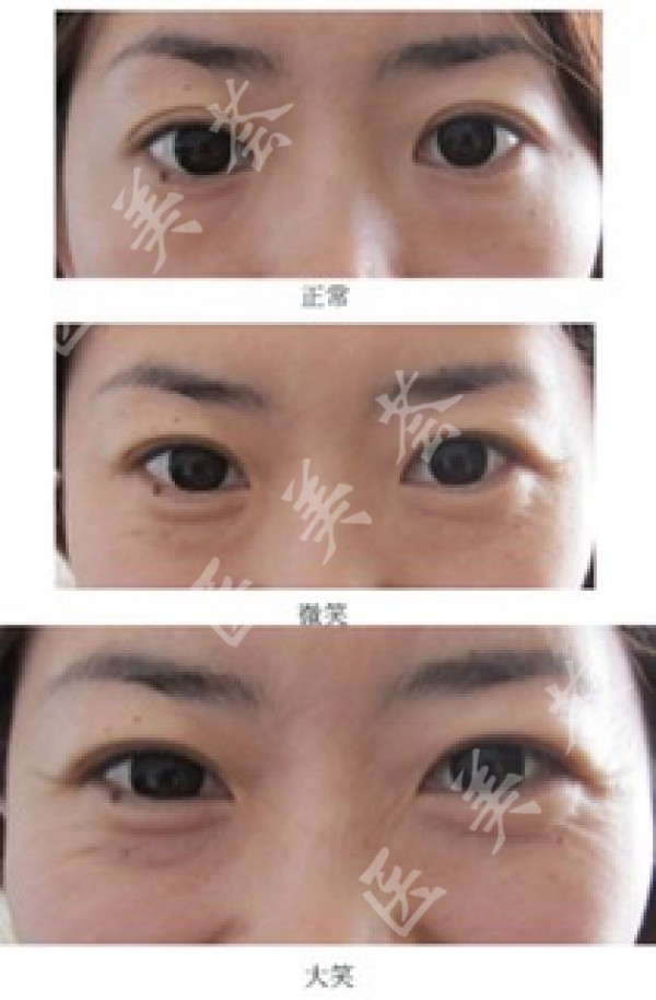 attachments-2020-03-6oQipOk05e65707f01e84.jpeg