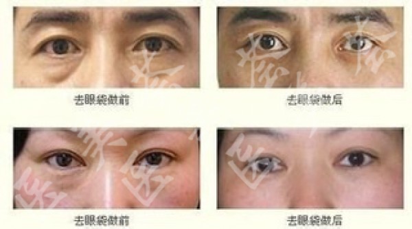 attachments-2020-03-Vfo3VnQ65e6b51d1202fb.jpeg