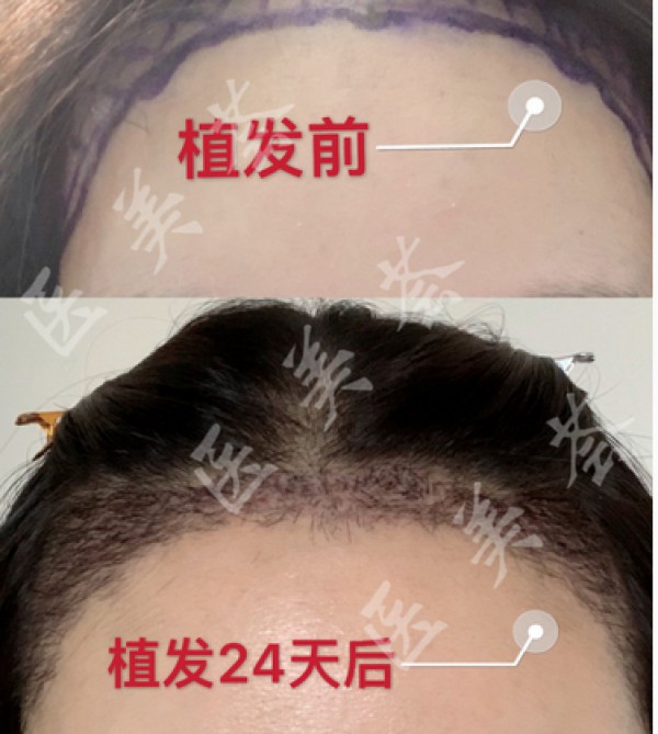 attachments-2020-03-XBqIlkPC5e7ed1c2b5e9d.png