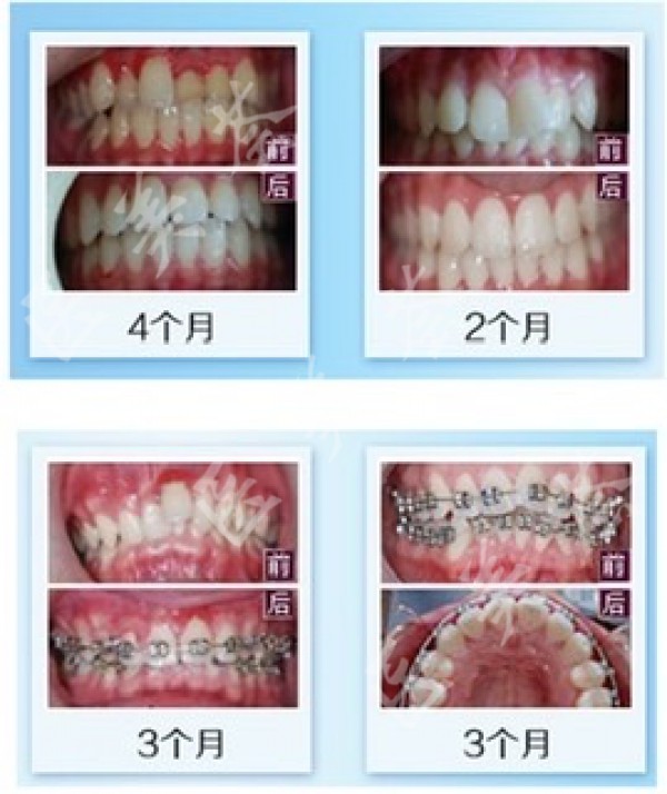 attachments-2020-04-SybUteeq5e8bf9757cba2.jpeg