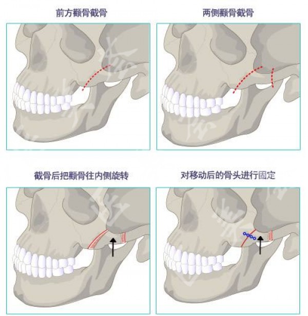 attachments-2020-05-IAQZ4GAQ5ec88560470c7.jpg