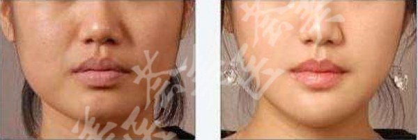 attachments-2020-06-DVD7ze6N5ee637fdcc699.png