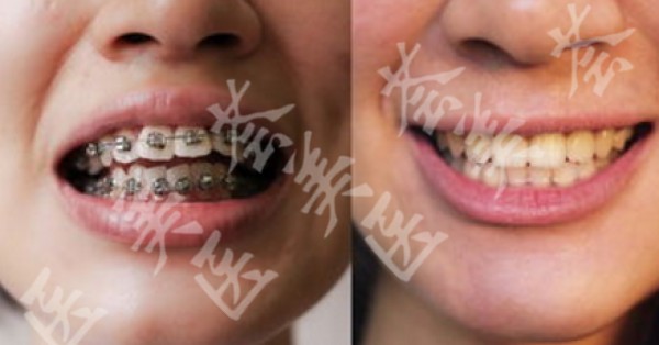 attachments-2020-06-ZROAgSGM5ef9e092173fa.png