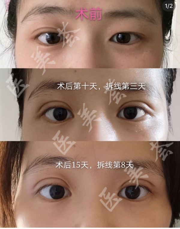 attachments-2022-03-SGHsWFiY623d419939b28.jpeg
