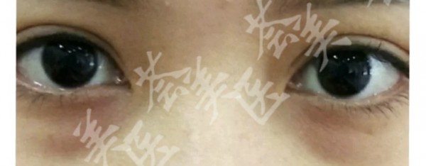 attachments-2022-03-SheAiELB623b068166481.jpeg