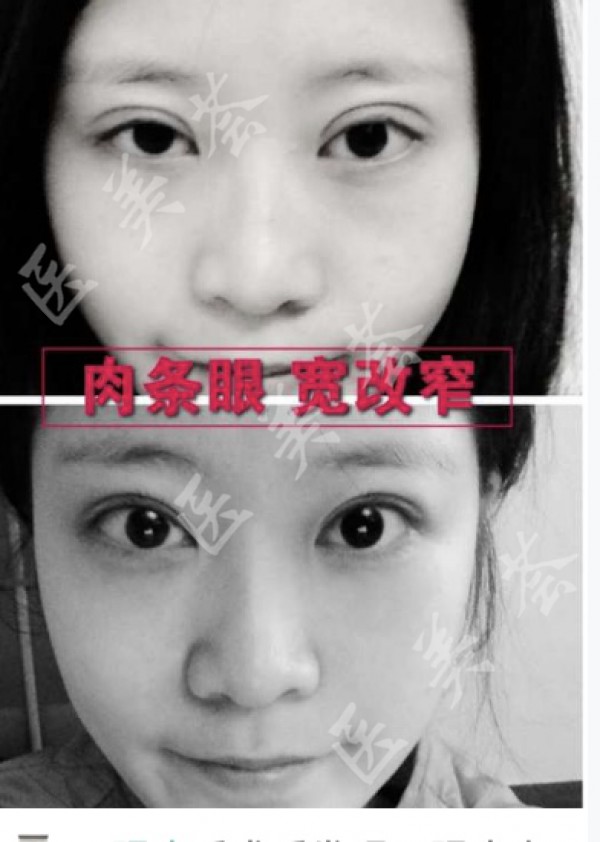 attachments-2022-03-yDtwRisy6242d4cb00b71.jpeg