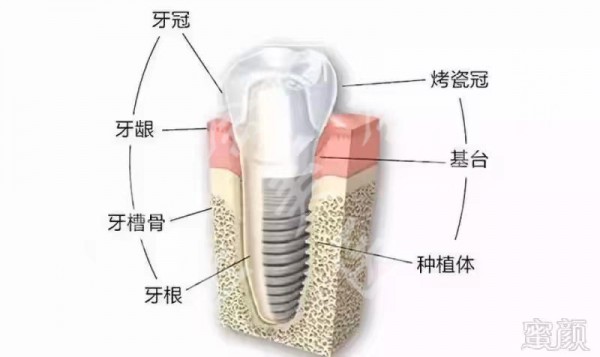 attachments-2020-09-DTOrZY2p5f55b189863ac.jpeg