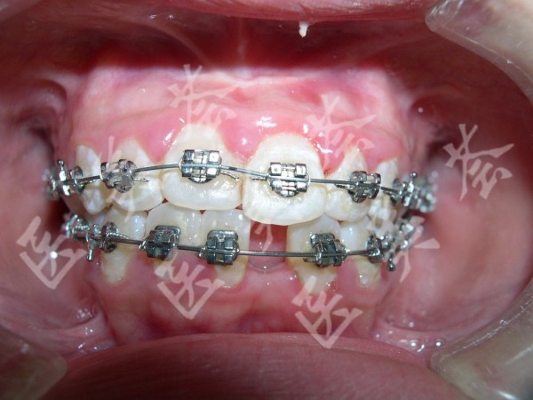 attachments-2020-09-G0zoDHhF5f5714189357b.jpeg