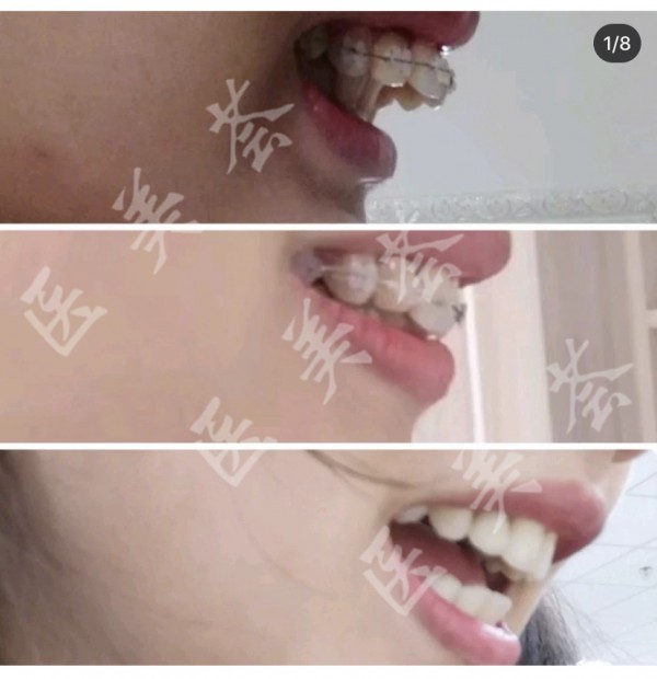attachments-2020-09-ODxoYJNb5f6457c49a04b.jpeg