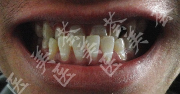 attachments-2020-12-0mtnd7Oj5fe14d6605b8d.jpeg