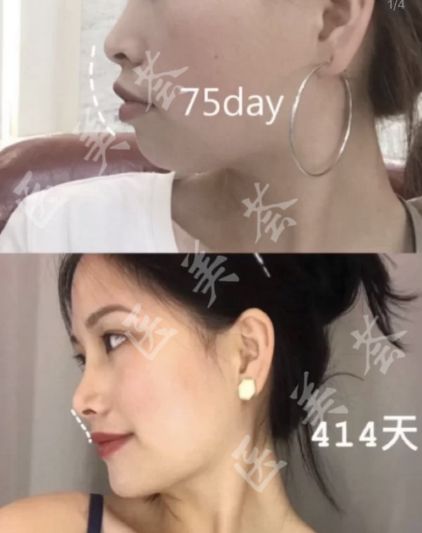 attachments-2020-12-1gddKZ4J5fe564700ca2d.jpeg