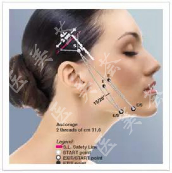 attachments-2020-12-ID3DThi95fd9629198d38.jpeg