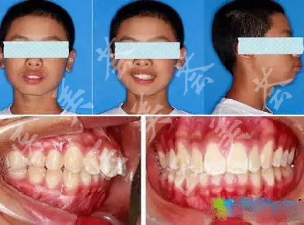 attachments-2020-12-Y7R5xtDA5fe14cb6de71c.jpeg