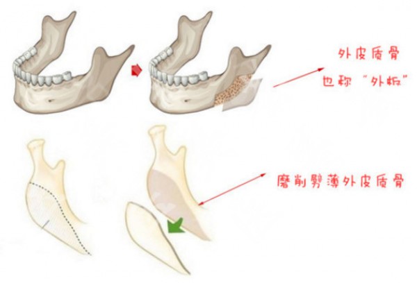 attachments-2020-12-b6Ixlj645fd18c1eb030f.jpeg