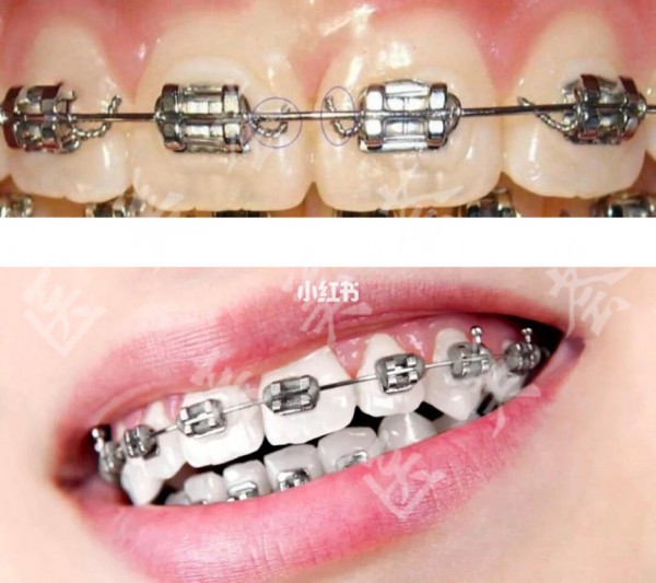 attachments-2020-12-gf96Ke8H5fd433ca05f5e.jpeg