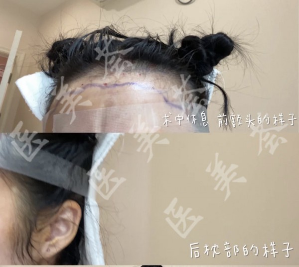 attachments-2020-12-pgmPj6GY5fd87119d023b.jpeg