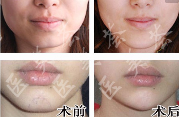 attachments-2020-12-qLmmCGgC5fe4060a378d3.png