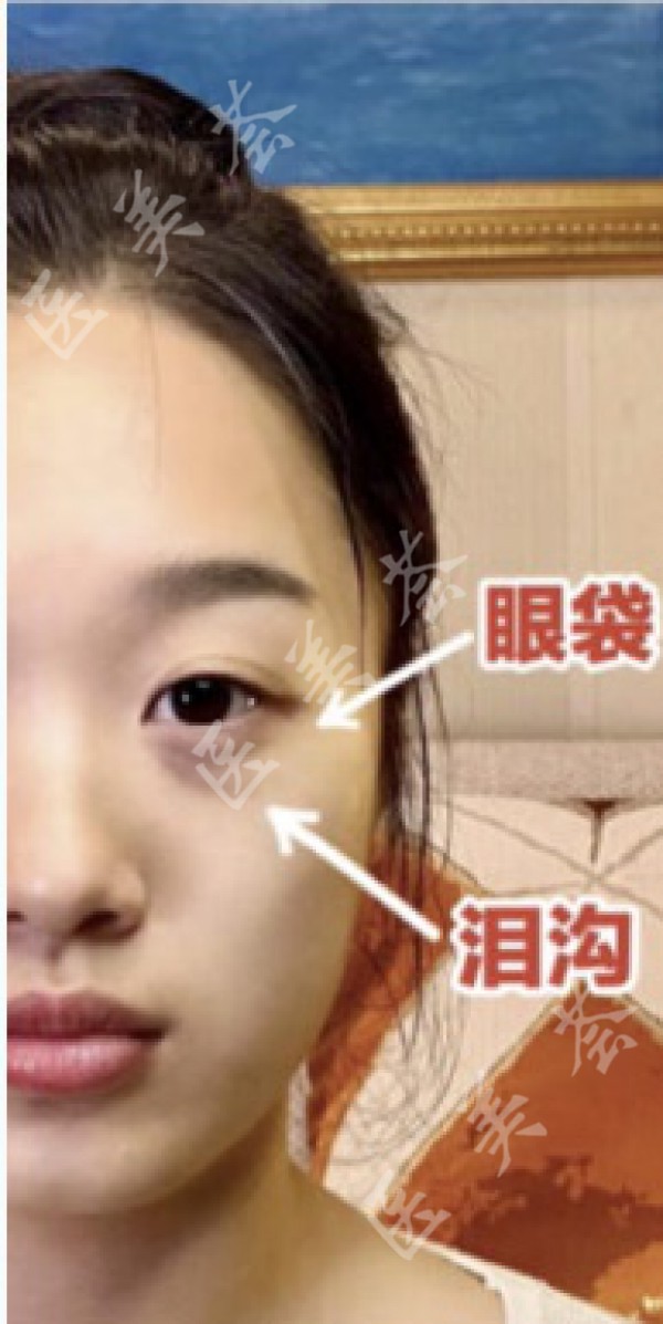 attachments-2020-12-xAwcRLvb5fed75157a4f0.jpeg
