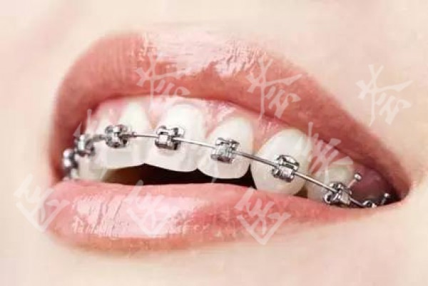 attachments-2020-12-zQPGO21s5fd35dae4fa1b.jpeg