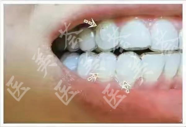 attachments-2021-01-SrwsMd8W6008f007cdfe6.jpeg