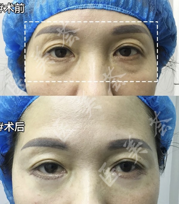 attachments-2021-01-VxN4ASH1600a306f2cd29.jpeg