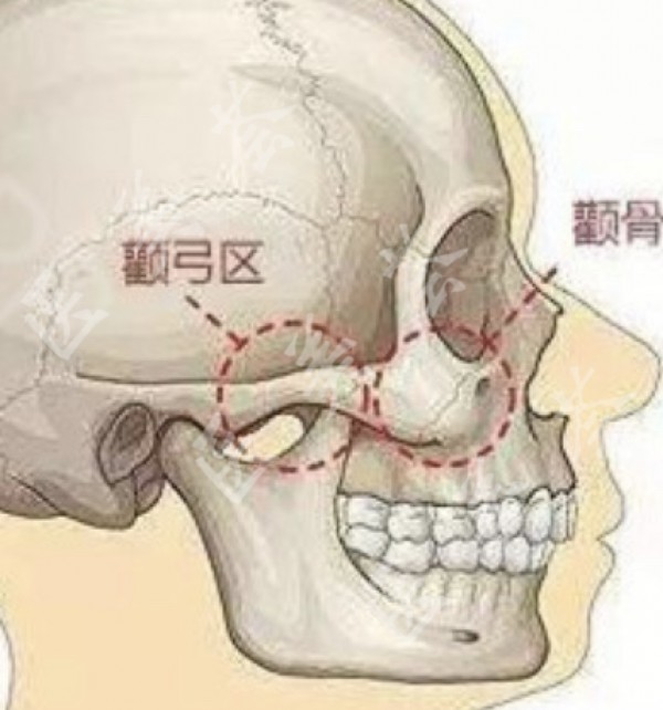 颧骨在脸部什么位置图片