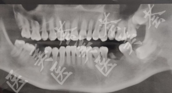 attachments-2021-01-qKS5ybNq5ff923aff1479.jpeg