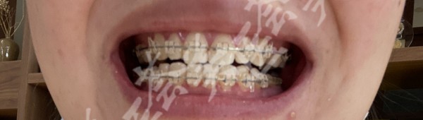 attachments-2021-01-rghlMbNZ5fffa9870ec82.jpeg