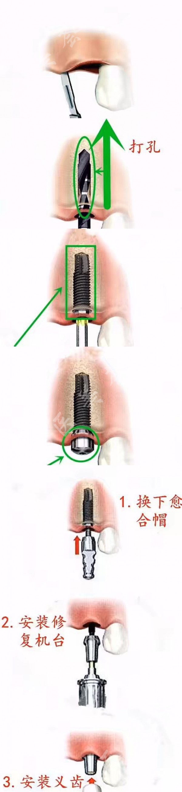 attachments-2021-02-0YbpG4vt601ba0e30d1ce.jpeg