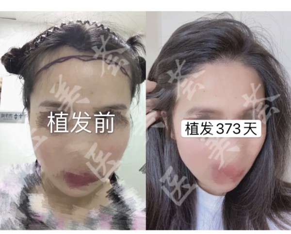 attachments-2021-02-MU2YKYvc601a05e2c6203.jpeg