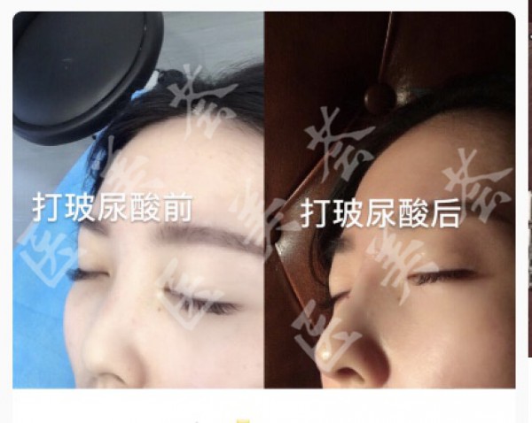 attachments-2021-02-WxvxIENI6035b3c884cc9.jpeg