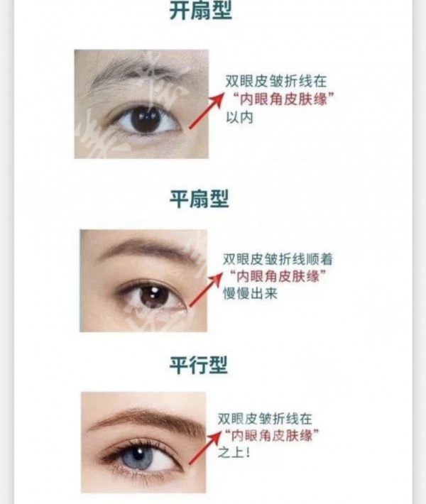 attachments-2021-03-5qc7VtyJ6061964d33bca.jpeg