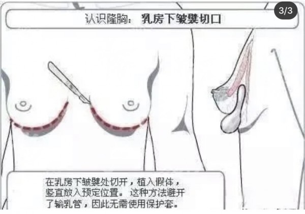 attachments-2021-03-OhG3ZHC7606288bbd4e86.jpeg