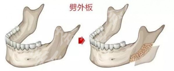 attachments-2021-03-qVQoTfY4605002db3eb43.jpeg