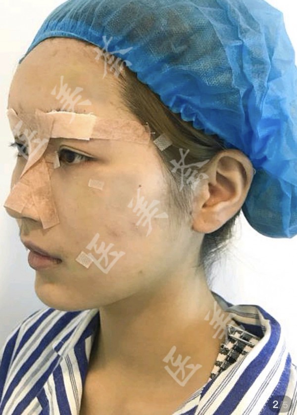 attachments-2021-03-xVtKRfs9603c936cd060b.jpeg