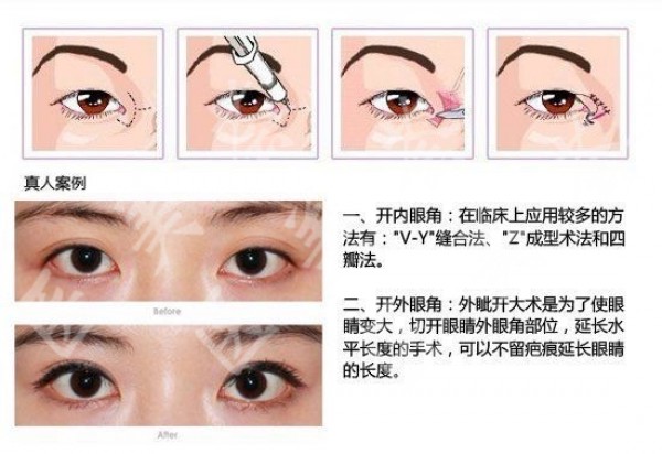 attachments-2021-03-yTICDQhU603ca5c89a41b.jpeg