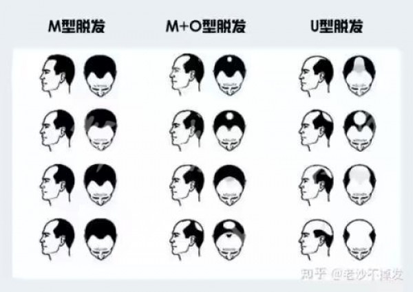 attachments-2021-04-1H37U53W607abe1d7e5ca.jpeg