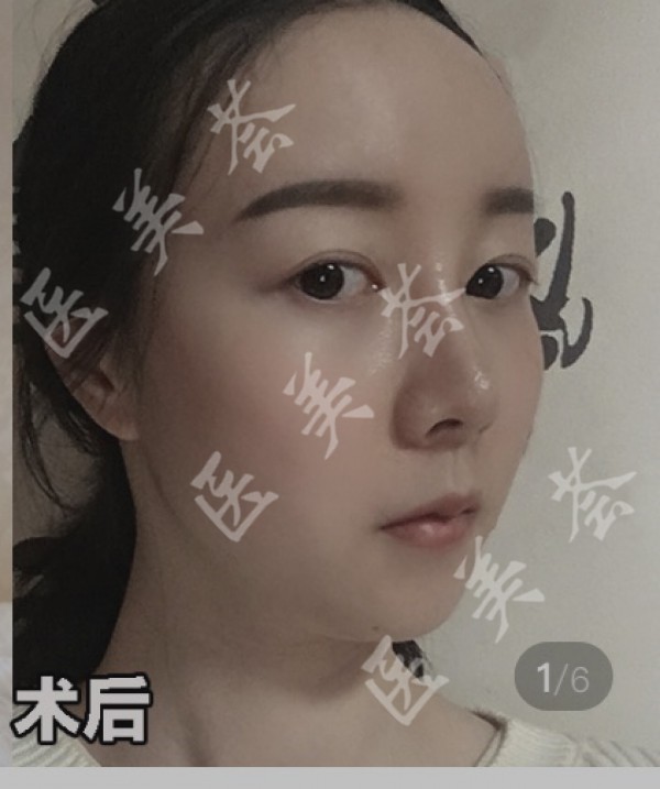 attachments-2021-04-Ivjs0xGT608381c9bb289.jpeg