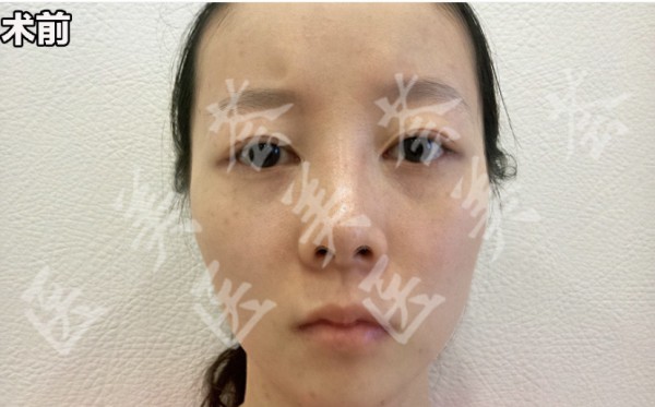 attachments-2021-04-Q5LxXcky608381bd14810.jpeg