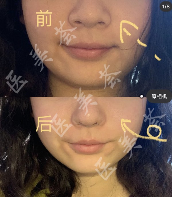 attachments-2021-04-YnixfJx4606d8a77a4453.jpeg