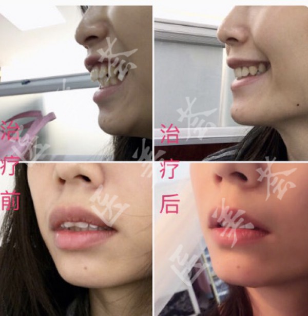 attachments-2021-04-p1meV2yN6087b63fe612e.jpeg