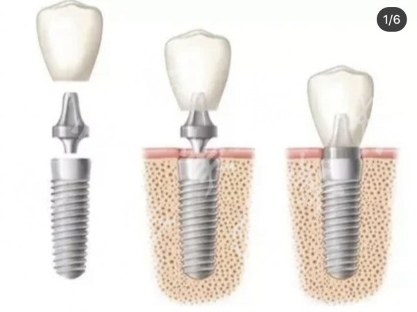 attachments-2021-05-6muDWKYB60a479fc872ee.jpeg