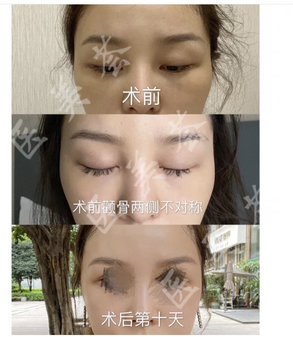 attachments-2021-05-CWCC7alZ6098a1ee8fc43.jpeg
