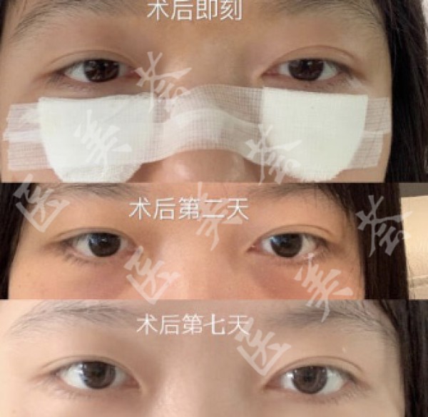 attachments-2021-05-HyBuSNf260a4a320134fd.jpeg