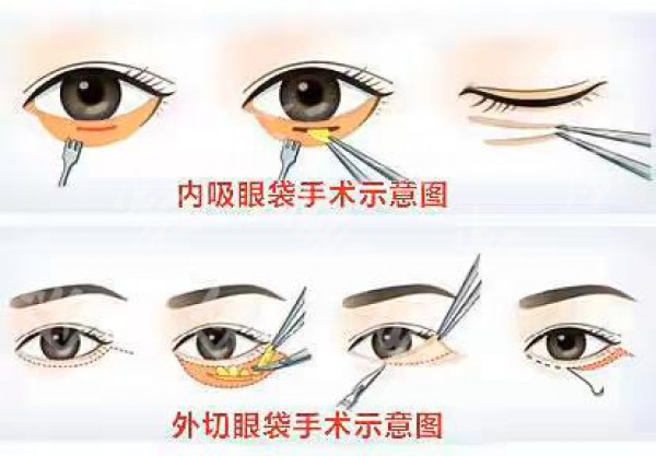 attachments-2021-05-WgWixWR260a9bfe5ed770.jpeg