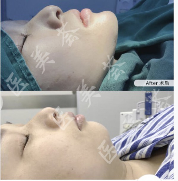 attachments-2021-05-k2WVeWtD60b36b6fa6e49.jpeg