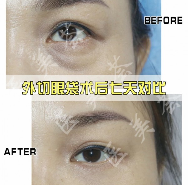 attachments-2021-05-lj1ywLHm60ac7806db585.jpeg