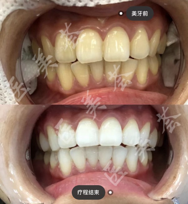 attachments-2021-05-vAHXPdAx6098d2165e69e.jpeg