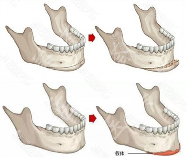 attachments-2021-05-zeAicg8s60b4c9babb289.png