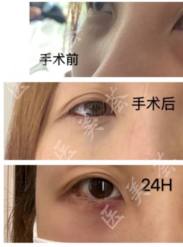 attachments-2021-06-1xGC338q60c99e9058ee1.jpeg